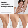 Фотоепілятор Braun PL1111 + GIL Venus Зображення